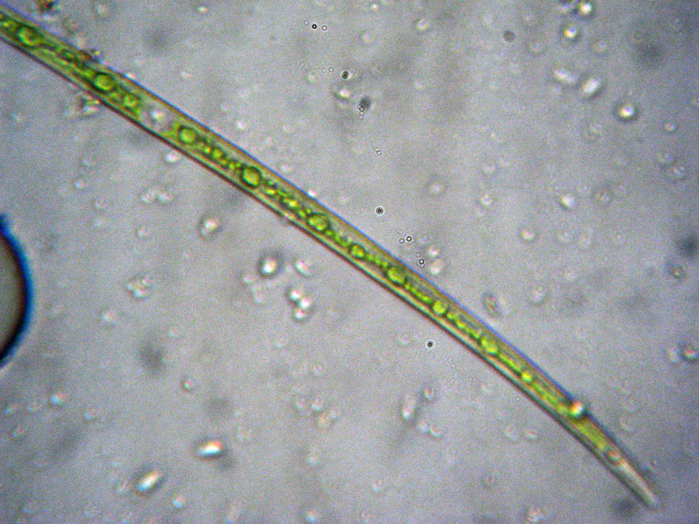 Closterium gracile?